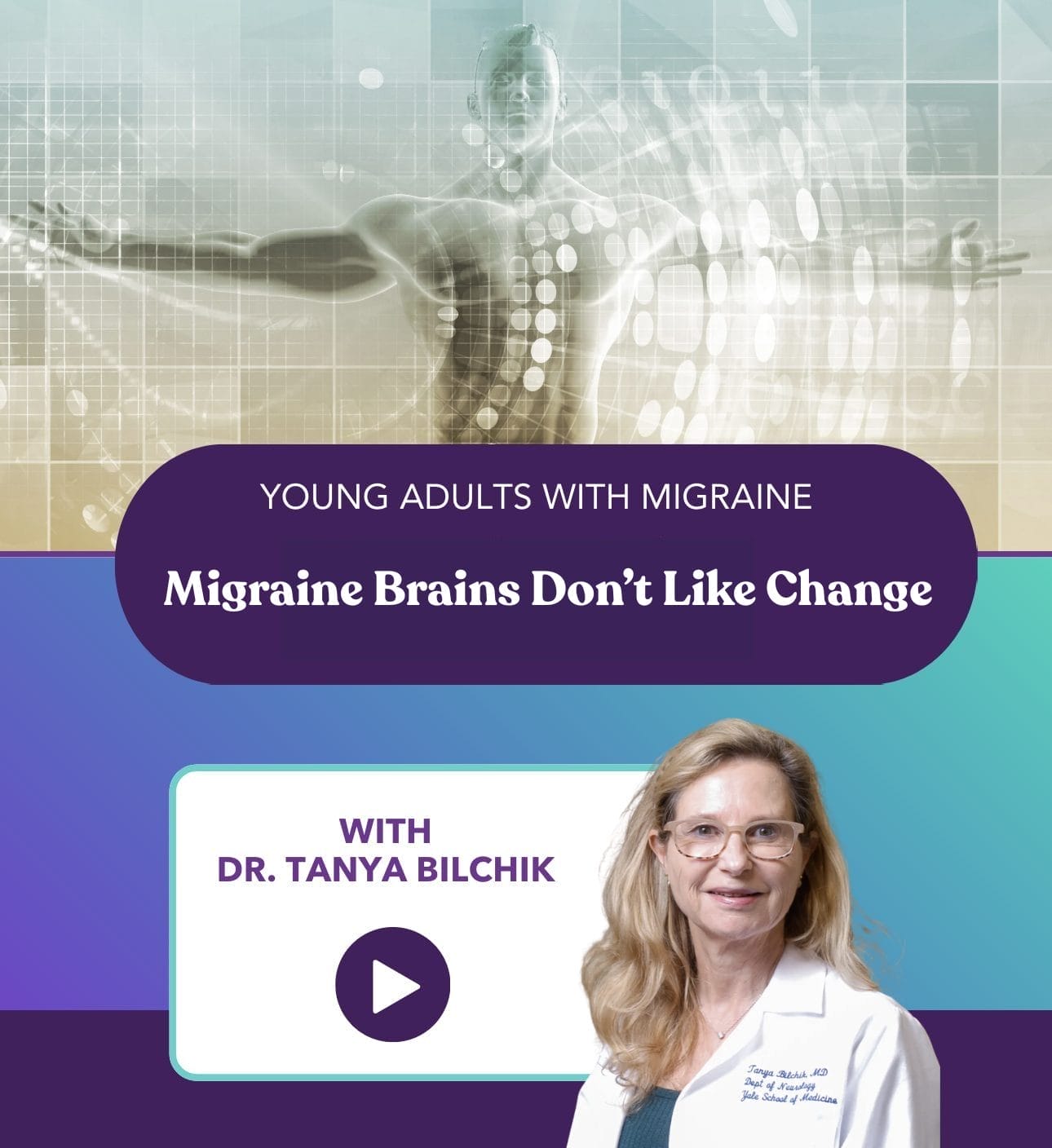 igraine Brains Don’t Like Change